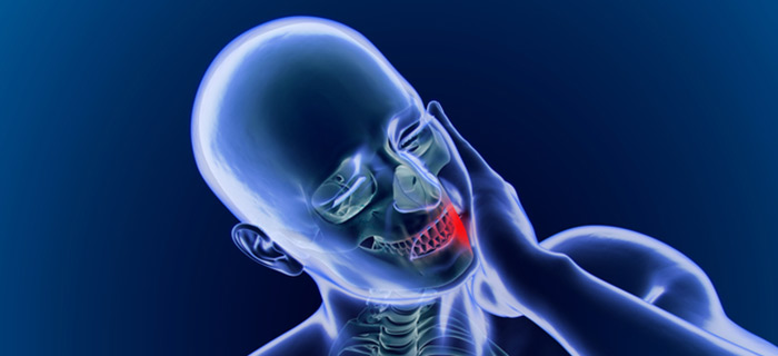 Jaw pain